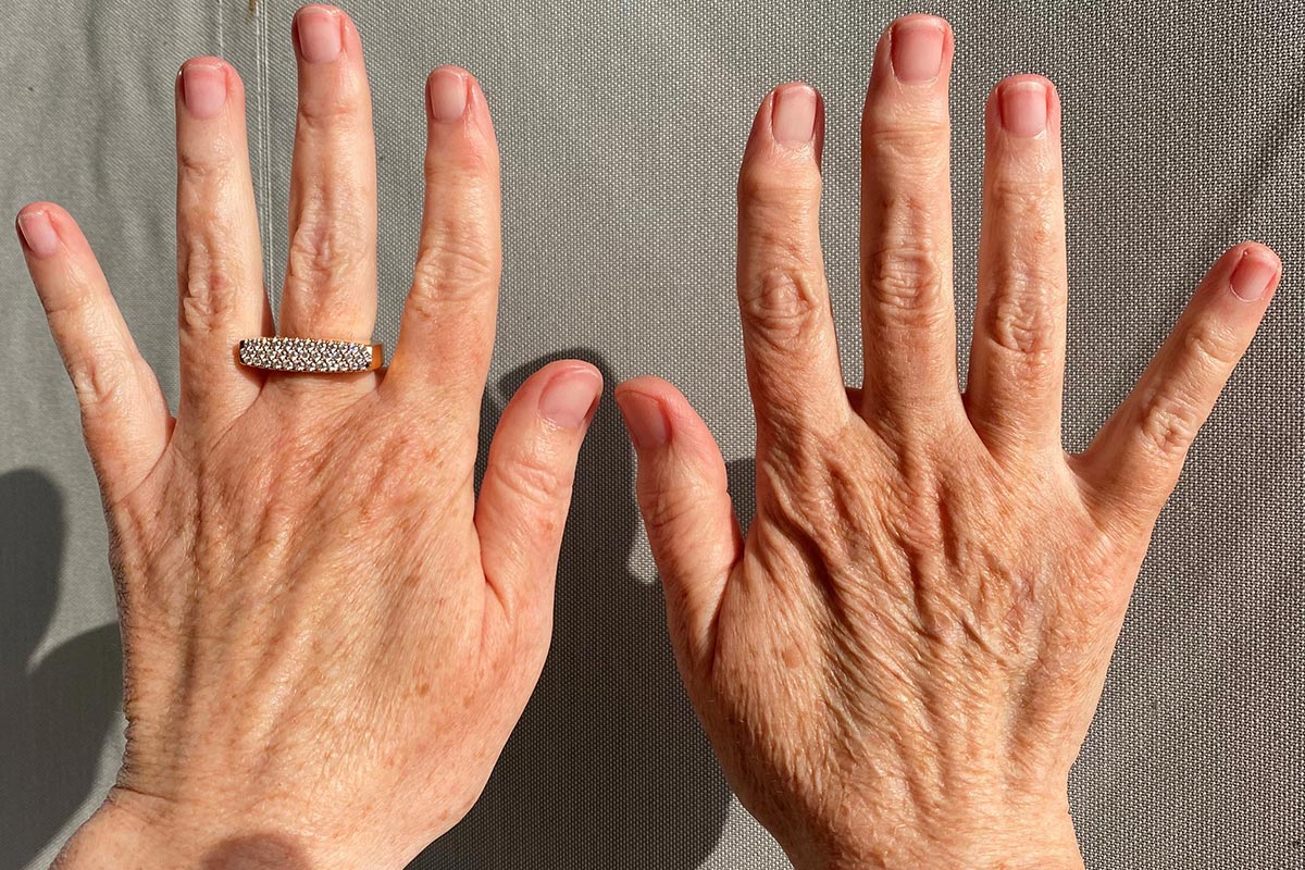 3.	BEWEI HANDS – für ein glatteres, strafferes und frischeres Hautbild Ihrer Hände mit Sofort-Effekt