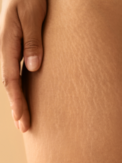 Teste jetzt die Cryo Styler Anwendung in Deinem No.1 Sun & Beauty Sonnenstudio